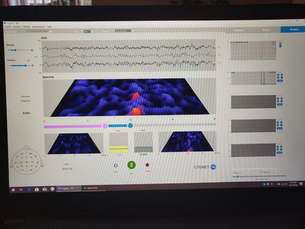 neurofeedback eeg - imagine a graficelor pe computer